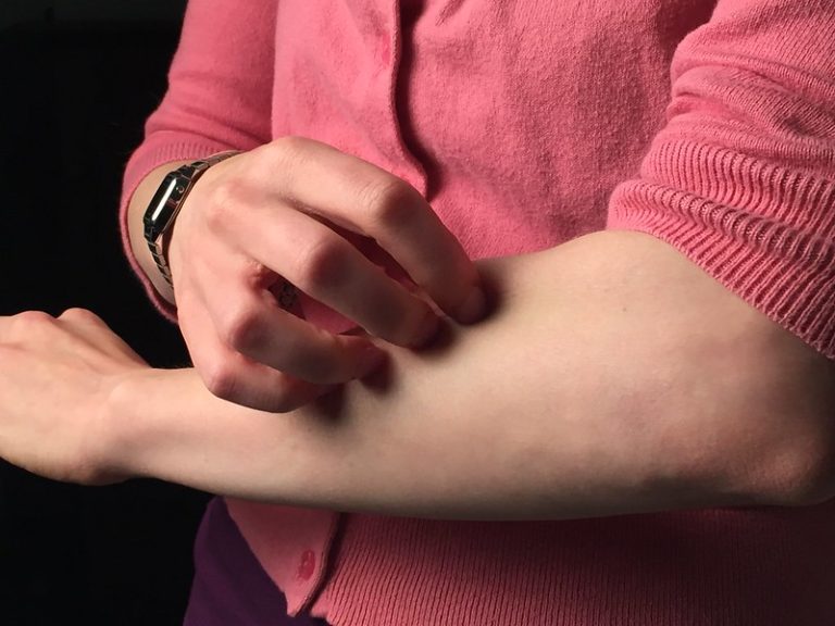 Scabies in the Netherlands: this itch is increasing