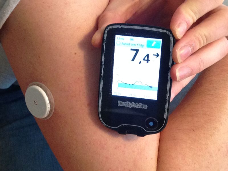 glucose moniter