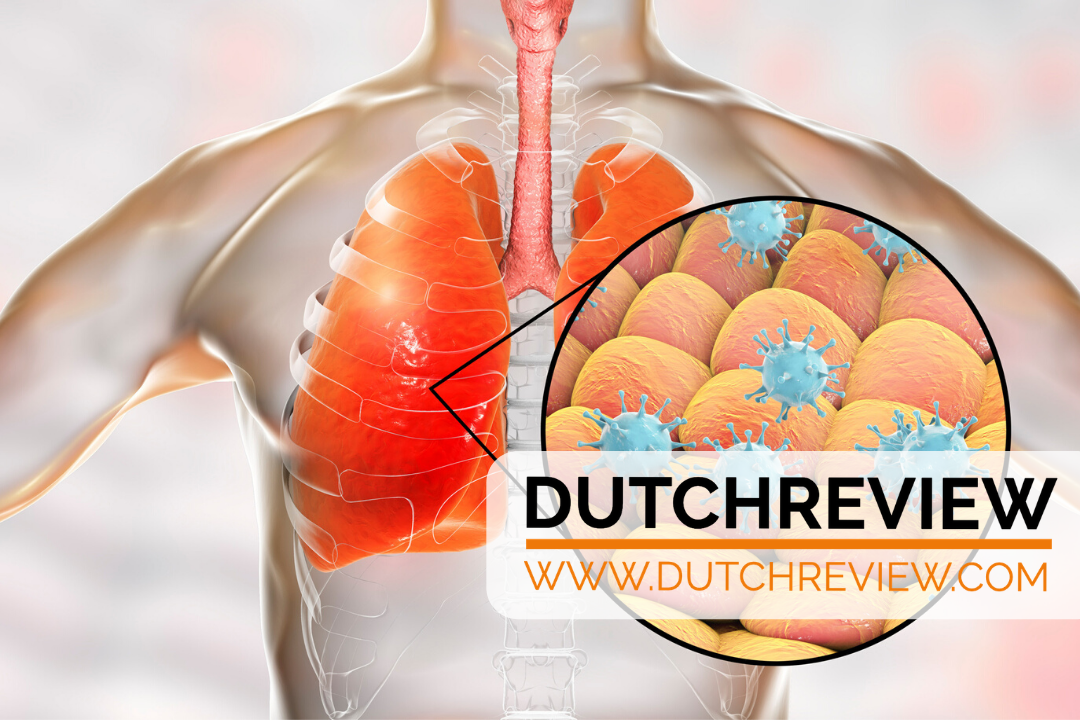 Hospitals to use one ventilator for several patients | DutchReview