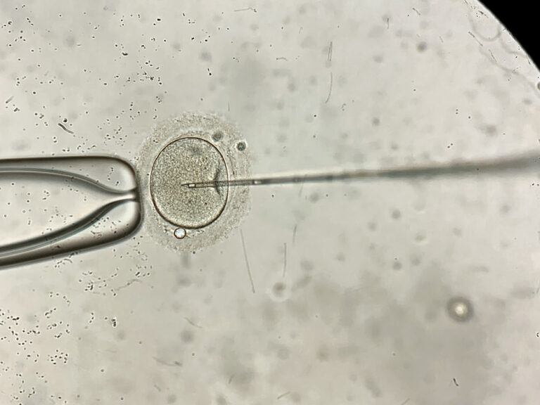 Ten Dutch fertility doctors impregnated patients with own sperm, investigation finds