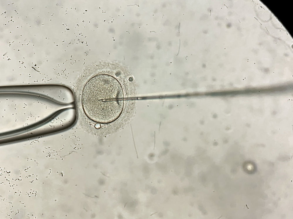 Picture-of-in-vitro-vertilization-under-the-microscope