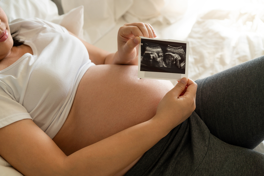 Pregnant-woman-lying-on-a-bed-with-white-sheets-holding-up-ultrasonic-image-of-embryo