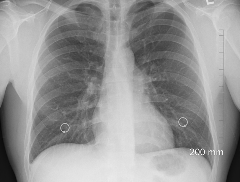 Dutch companies lead the way in developing x-ray software to diagnose coronavirus