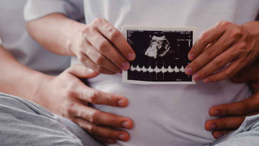 Couple-holding-an-ultrasound-of-their-baby-in-the-Netherlands