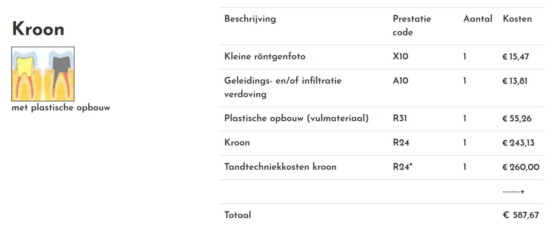 Dental costs and dental insurance in the Netherlands 5 questions you