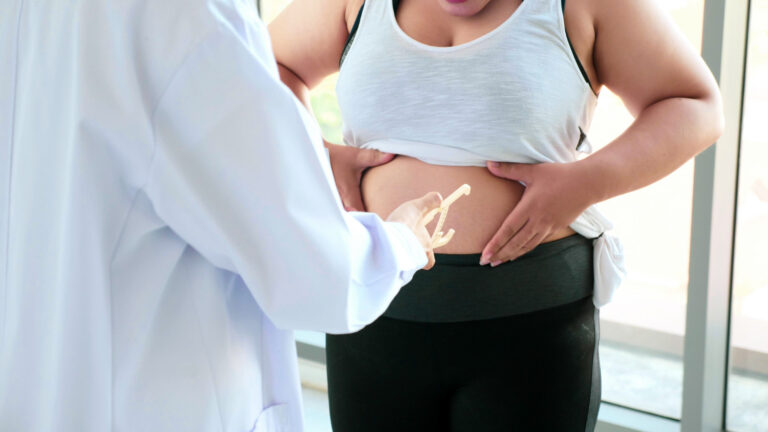 More Dutch people are visiting doctors about their weight